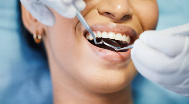 Best Emergency Dental Care for Sports Injuries in Maysville, MO